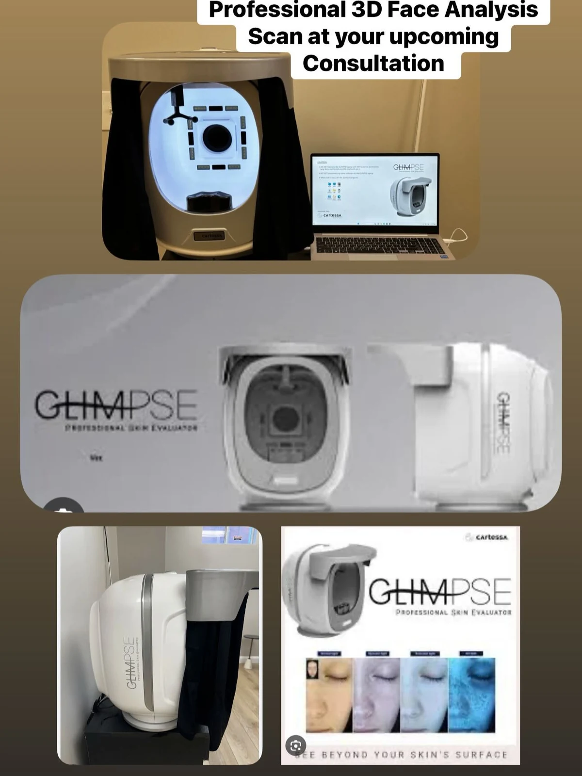 GLIMPSE skin imaging used to support skin assessment at Grace MedSpa