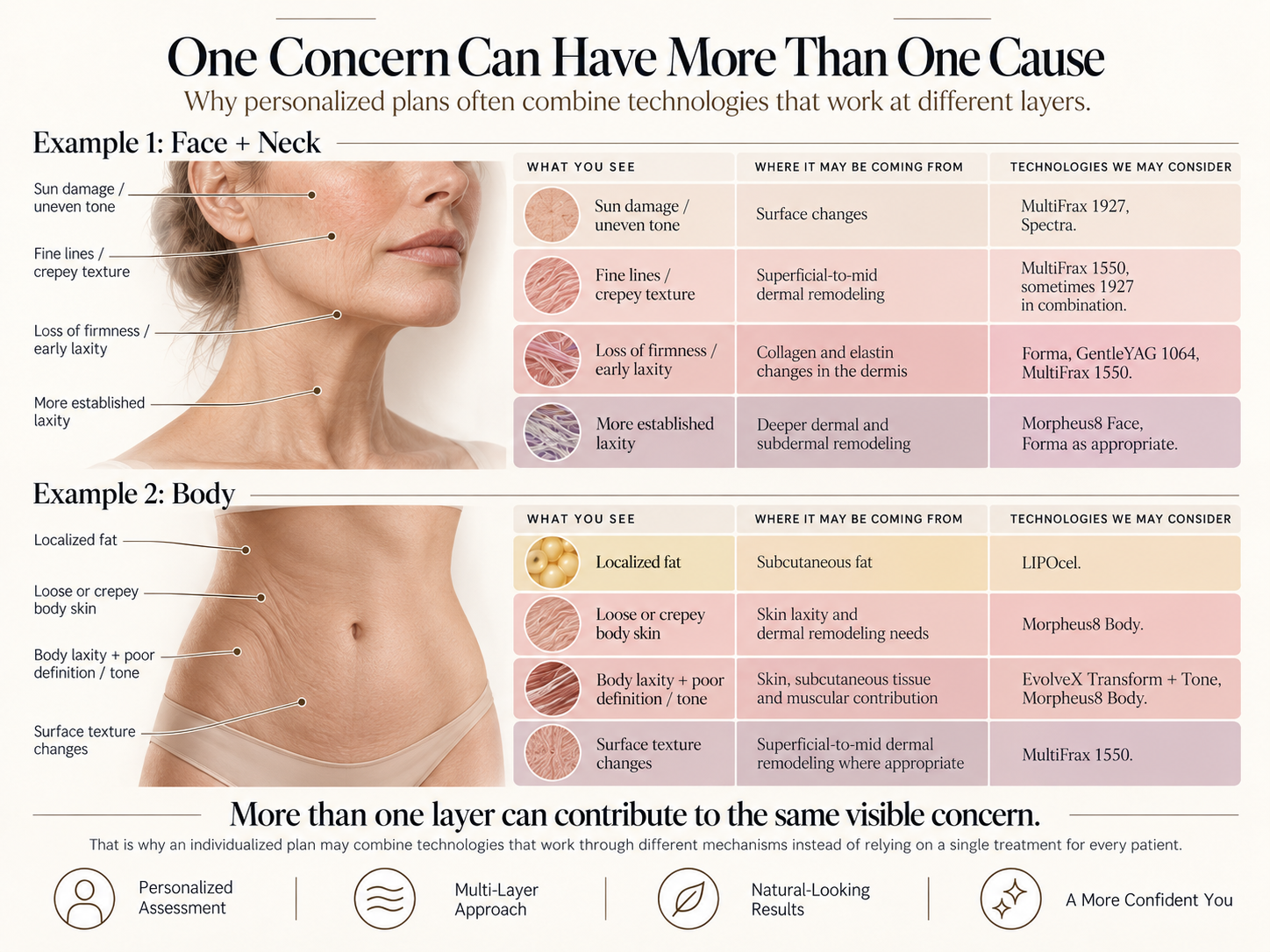 Face, neck and abdomen examples showing how visible concerns can arise from different tissue levels