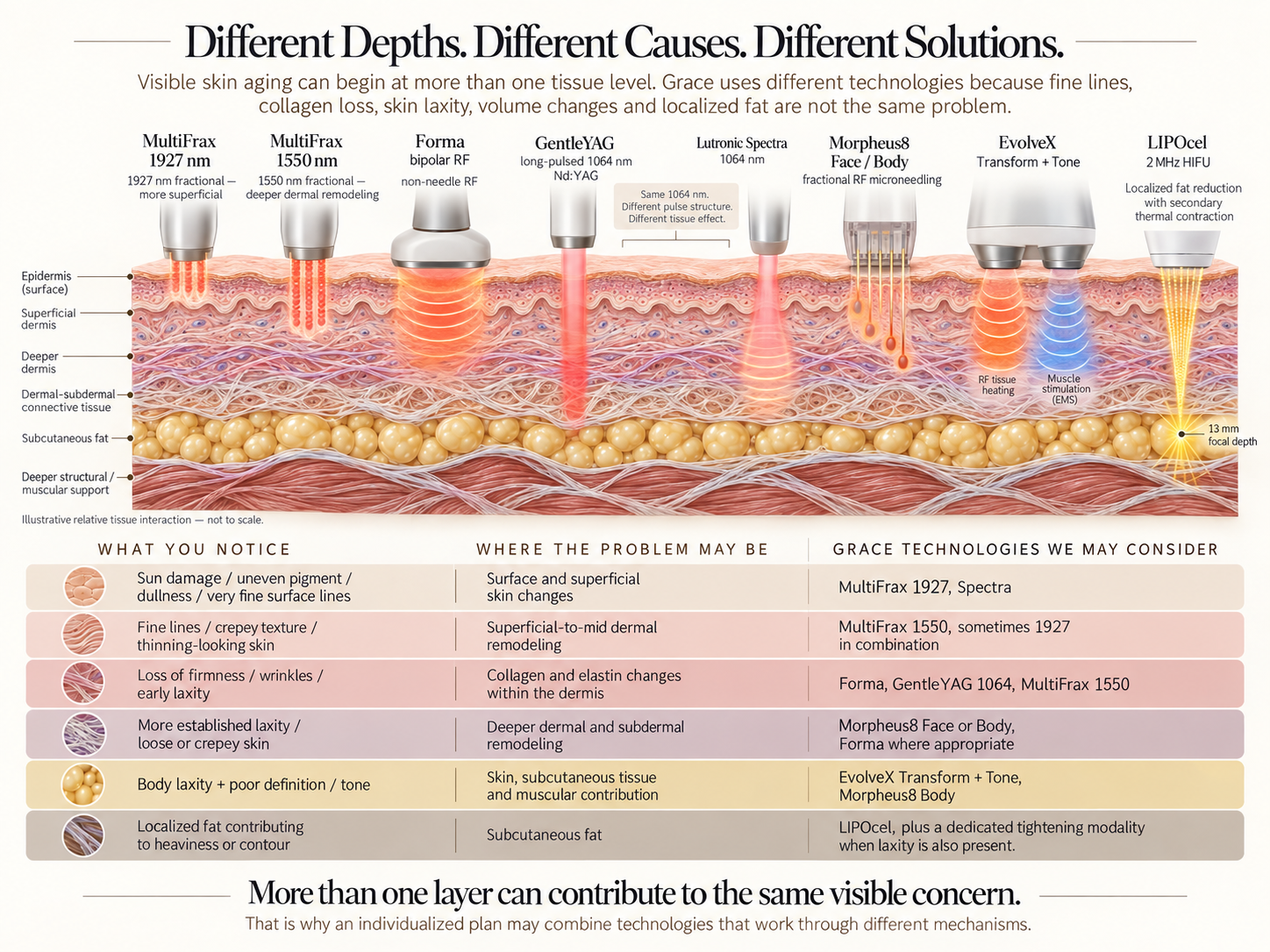 Educational comparison of relative tissue interaction for Grace skin tightening and body contouring technologies