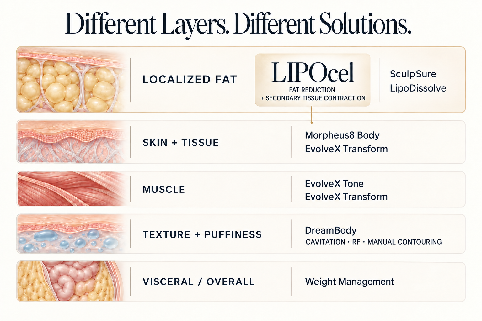 Grace MedSpa treatment map matching localized fat, skin and tissue, muscle, texture and puffiness, and visceral or overall concerns with appropriate body-contouring options.