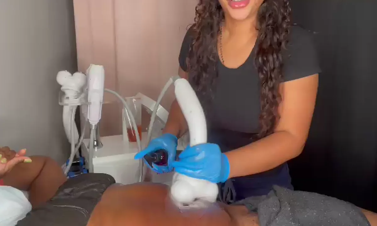 DreamBody body-contouring treatment being performed at Grace MedSpa
