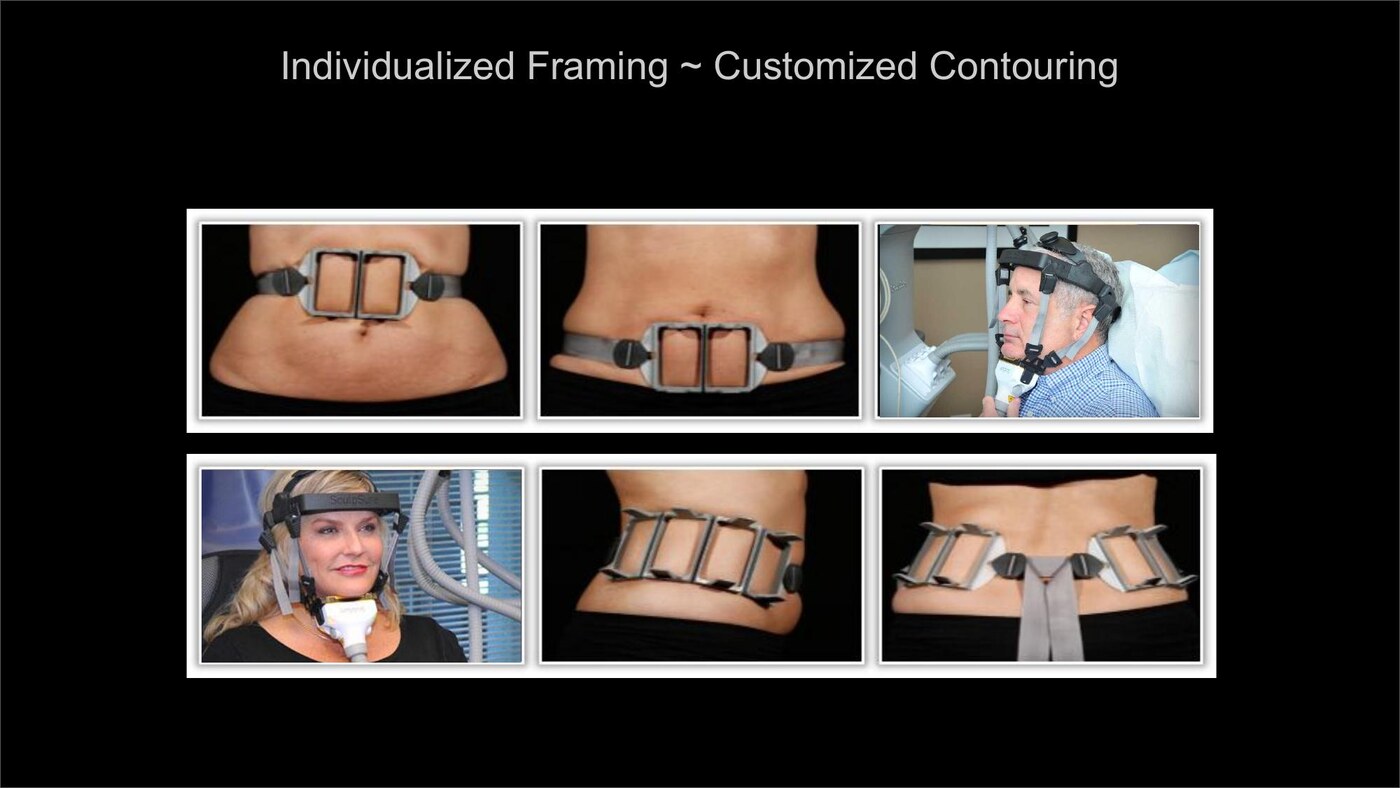 Manufacturer reference showing SculpSure applicator framing and placement across different treatment areas